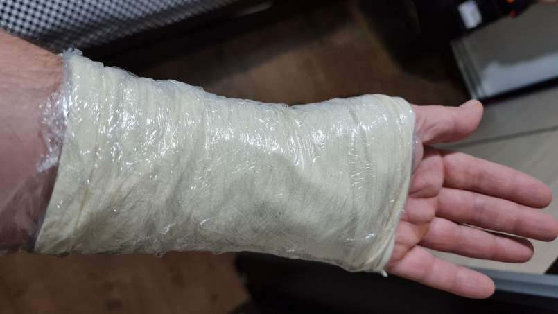 Okład z loys i liści kapusty, zdjęcie 8